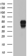 HEK293T cells were transfected with the pCMV6-ENTRY control (Left lane) or pCMV6-ENTRY SGK196 (Right lane) cDNA for 48 hrs and lysed. Equivalent amounts of cell lysates (5 ug per lane) were separated by SDS-PAGE and immunoblotted with anti-SGK196.