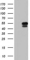 HEK293T cells were transfected with the pCMV6-ENTRY control (Left lane) or pCMV6-ENTRY SGK196 (Right lane) cDNA for 48 hrs and lysed. Equivalent amounts of cell lysates (5 ug per lane) were separated by SDS-PAGE and immunoblotted with anti-SGK196.