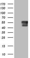 HEK293T cells were transfected with the pCMV6-ENTRY control (Left lane) or pCMV6-ENTRY SGK196 (Right lane) cDNA for 48 hrs and lysed. Equivalent amounts of cell lysates (5 ug per lane) were separated by SDS-PAGE and immunoblotted with anti-SGK196.