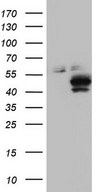 HEK293T cells were transfected with the pCMV6-ENTRY control (Left lane) or pCMV6-ENTRY SGK196 (Right lane) cDNA for 48 hrs and lysed. Equivalent amounts of cell lysates (5 ug per lane) were separated by SDS-PAGE and immunoblotted with anti-SGK196.