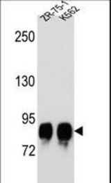 POMT1 Antibody western blot of ZR-75-1,K562 cell line lysates (35 ug/lane). The POMT1 antibody detected the POMT1 protein (arrow).