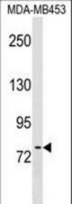 POMT2 Antibody western blot of MDA-MB453 cell line lysates (35 ug/lane). The POMT2 antibody detected the POMT2 protein (arrow).