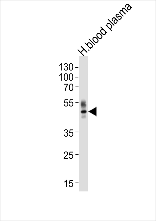 Western blot of lysate from human blood plasma tissue lysate, using PON1 Antibody. Antibody was diluted at 1:1000 at each lane. A goat anti-rabbit IgG H&L (HRP) at 1:5000 dilution was used as the secondary antibody. Lysate at 35ug per lane.