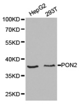 Western blot of extracts of various cell lines, using PON2 antibody.