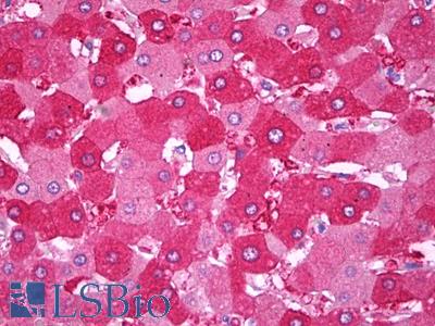 Anti-PON3 antibody IHC of human liver. Immunohistochemistry of formalin-fixed, paraffin-embedded tissue after heat-induced antigen retrieval. Antibody LS-B7136 dilution 1:400.