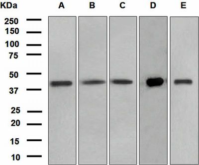 Western blot analysis on (A) fetal liver, (B) A549, (C) HepG2, (D) mouse kidney, and (E) mouse liver lysates using anti-PON3 antibody.