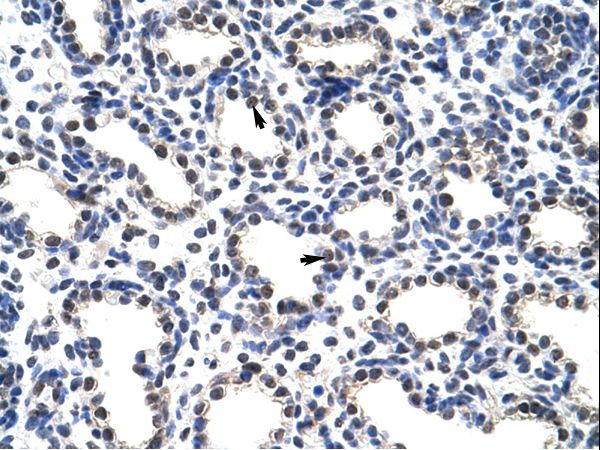 POP4 antibody LS-C30617 was used in IHC to stain formalin-fixed, paraffin-embedded human lung.