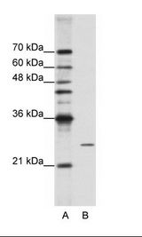 A: Marker, B: HepG2 Cell Lysate