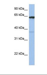 Jurkat cell lysate. Antibody concentration: 1.0 ug/ml. Gel concentration: 12%.