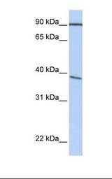 HepG2 cell lysate. Antibody concentration: 1.0 ug/ml. Gel concentration: 12%.
