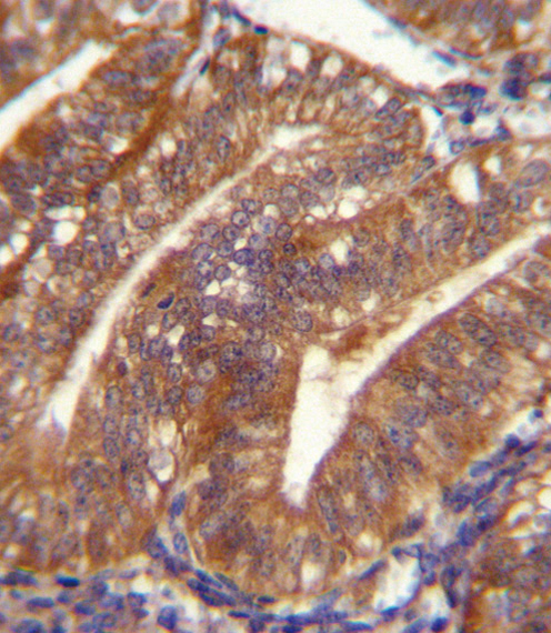 POSTN Antibody immunohistochemistry of formalin-fixed and paraffin-embedded human uterus tissue followed by peroxidase-conjugated secondary antibody and DAB staining.