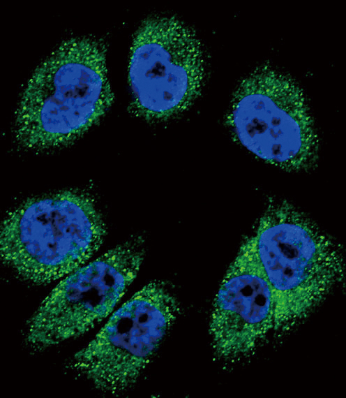 Confocal immunofluorescent of POSTN Antibody with A375 cell followed by Alexa Fluor 488-conjugated goat anti-rabbit lgG (green). DAPI was used to stain the cell nuclear (blue).