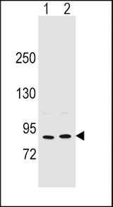 POSTN Antibody western blot of MCF-7(lane 1),A375(lane 2) cell line lysates (35 ug/lane). The POSTN antibody detected the POSTN protein (arrow).