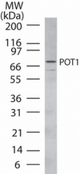 Western blot of POT1 in HL60 cell lysate using antibody at 2 ug/ml.