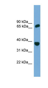 POT1 antibody LS-C116785 Western blot of THP-1 cell lysate.