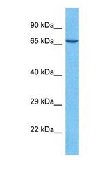 Western blot of POTE1 Antibody with human RPMI-8226 Whole Cell lysate.
