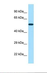 Western blot of Human Jurkat. POTEA antibody dilution 1.0 ug/ml.