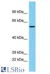 POTEA / POTE8 antibody Western Blot of Jurkat. Antibody dilution: 1 ug/ml.