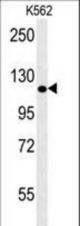 POTEE Antibody western blot of K562 cell line lysates (35 ug/lane). The POTEE antibody detected the POTEE protein (arrow).