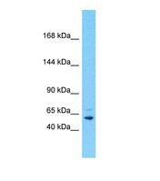 Western blot of Human Placenta. POTEF antibody dilution 1.0 ug/ml.