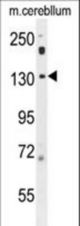 POTEF Antibody western blot of mouse cerebellum tissue lysates (35 ug/lane). The POTEF antibody detected the POTEF protein (arrow).