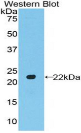 Western blot of recombinant POTEG.