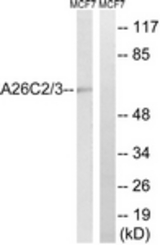 Western blot of extracts from MCF-7 cells, using A26C2/3 Antibody. The lane on the right is treated with the synthesized peptide.