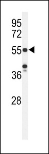 Western blot of POTEH Antibody in HeLa cell line lysates (35 ug/lane). POTEH (arrow) was detected using the purified antibody.