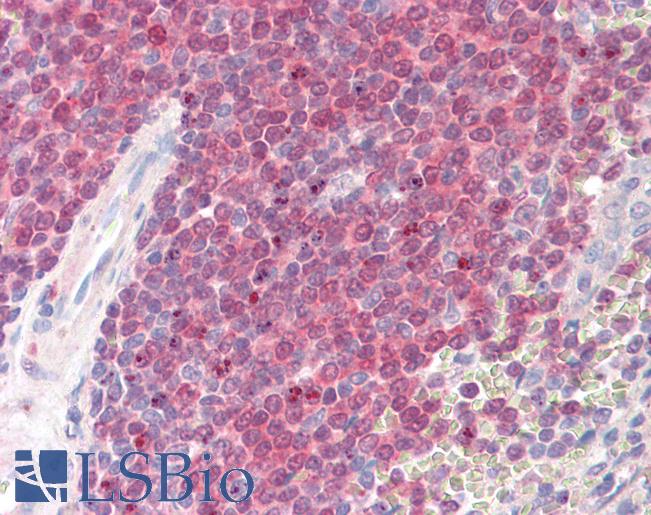 Anti-POU2AF1 / BOB1 antibody IHC of human spleen. Immunohistochemistry of formalin-fixed, paraffin-embedded tissue after heat-induced antigen retrieval. Antibody LS-B8331 dilution 3.75 ug/ml.