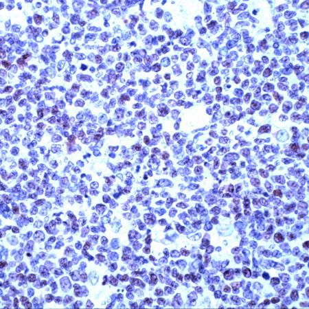 Human tonsil stained with Anti-Oct-1 antibody