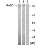 Western blot analysis of extracts from HepG2 cells, using POU2F1/OCT1 (Ab-385) Antibody. The lane on the right is treated with the synthesized peptide.