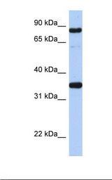 Transfected 293T cell lysate. Antibody concentration: 1.0 ug/ml. Gel concentration: 12%.