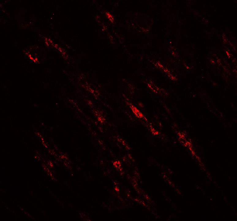 Immunofluorescence of POU2F3 in rat brain tissue with POU2F3 antibody at 20 ug/mL.