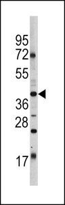 Western blot of OCT3/4 Antibody (E125) in HL60 cell line lysates (35 ug/lane). OCT3/4 (arrow) was detected using the purified antibody.