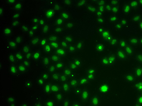Immunofluorescence blot of MCF7 cell using POU6F1 antibody.