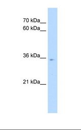 HepG2 cell lysate. Antibody concentration: 1.0 ug/ml. Gel concentration: 12%.