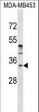 POU6F1 Antibody western blot of MDA-MB453 cell line lysates (35 ug/lane). The POU6F1 antibody detected the POU6F1 protein (arrow).