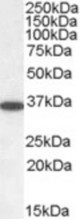 Antibody (0.05 ug/ml) staining of Human Cerebellum lysate (35 ug protein/ml in RIPA buffer). Primary incubation was 1 hour. Detected by chemiluminescence.