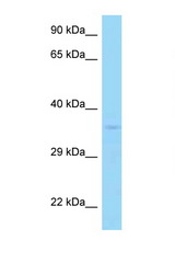 PPP2CA / PP2Ac antibody LS-C146161 Western blot of 435S Cell lysate. Antibody concentration 1 ug/ml.