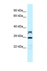 PPP2CA / PP2Ac antibody LS-C145870 Western blot of Rat Brain lysate. Antibody concentration 1 ug/ml.