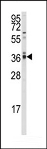 Western blot of anti-hPPP2CA/B Antibody in A2058 cell line lysates (35 ug/lane). PPP2CA/B (arrow) was detected using the purified antibody.