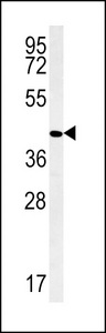 PPAN Antibody western blot of ZR-75-1 cell line lysates (35 ug/lane). The PPAN antibody detected the PPAN protein (arrow).