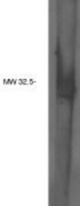 Western blot of Pan PPAP antibody on human brain lysate.
