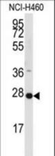 Western blot of anti-PPAP2C Antibody in NCI-H460 cell line lysates (35 ug/lane). PPAP2C(arrow) was detected using the purified antibody.