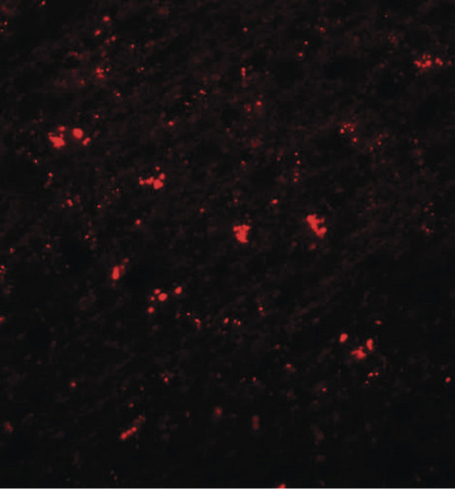 Immunofluorescence of PPAPDC1A in human brain tissue with PPAPDC1A antibody at 20 ug/ml.