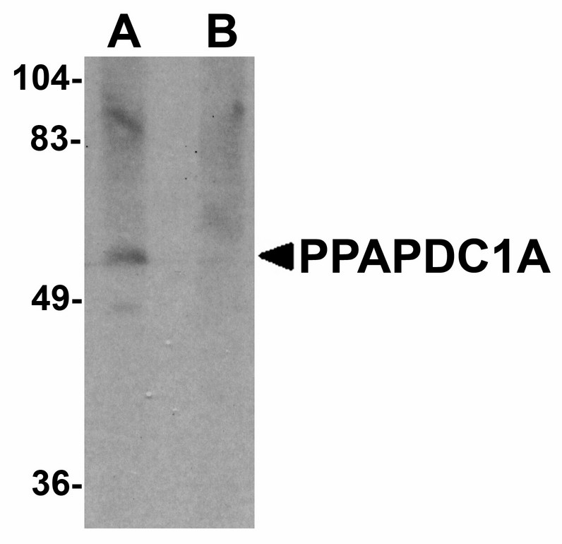 Western blot of PPAPDC1A in human brain tissue lysate with PPAPDC1A antibody at 1 ug/ml in (A) the absence and (B) the presence of blocking peptide.