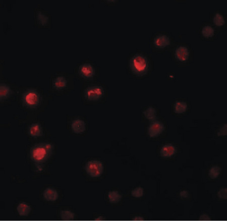 Immunofluorescence of PPAPDC2 in Raji cells with PPAPDC2 antibody at 20 ug/ml.