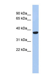 PPAPDC2 antibody LS-C111761 Western blot of Fetal Heart lysate.