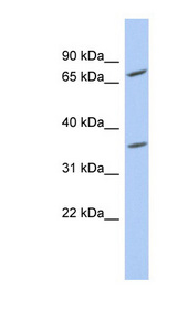 PPAPDC2 antibody LS-C111762 Western blot of HeLa lysate.