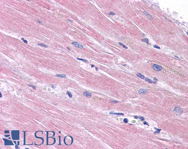 Anti-PPAPDC3 antibody IHC of human heart. Immunohistochemistry of formalin-fixed, paraffin-embedded tissue after heat-induced antigen retrieval. Antibody LS-B5058 concentration 5 ug/ml.